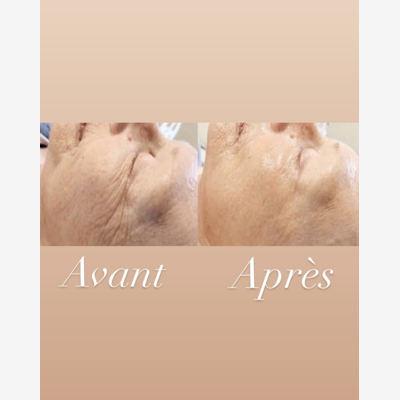 image_Soins du visage
