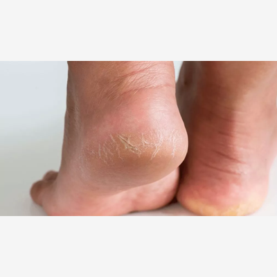 image_Bien être du pied