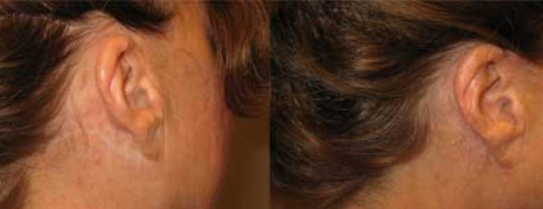 image_MAQUILLAGE PERMANENT DERMOGRAPHIE ESTHETIQUE ET REPARATRICE