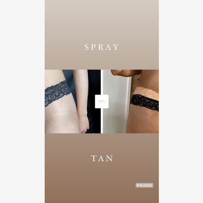 image_BLANCHIMENT DENTAIRE|STRASS DENTAIRE|SPRAY TAN
