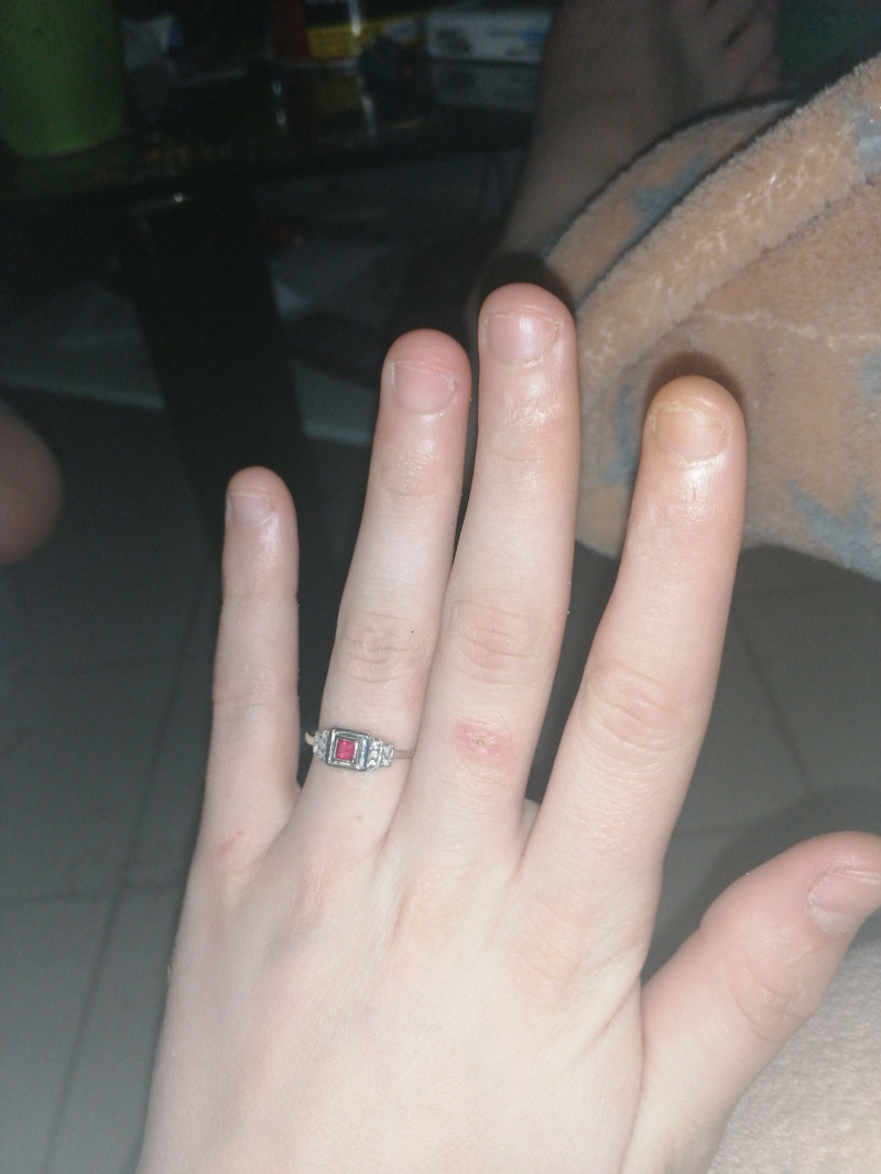 image_Pose ongles